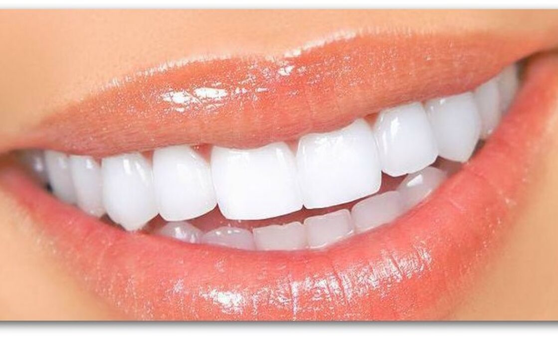 The Secret Behind Whiter Teeth….Naturally! - Dental Excellence | Dentist in  Chalfont St Giles, Buckinghamshire